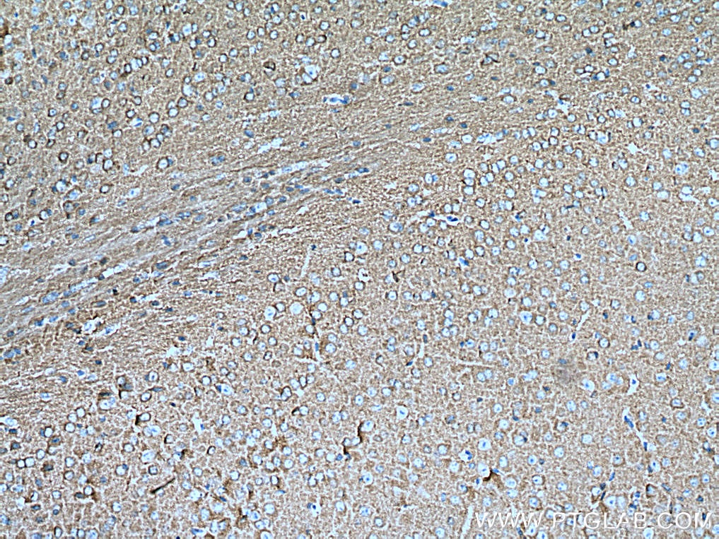 Immunohistochemistry (IHC) staining of mouse brain tissue using IRSp53 Polyclonal antibody (11087-2-AP)