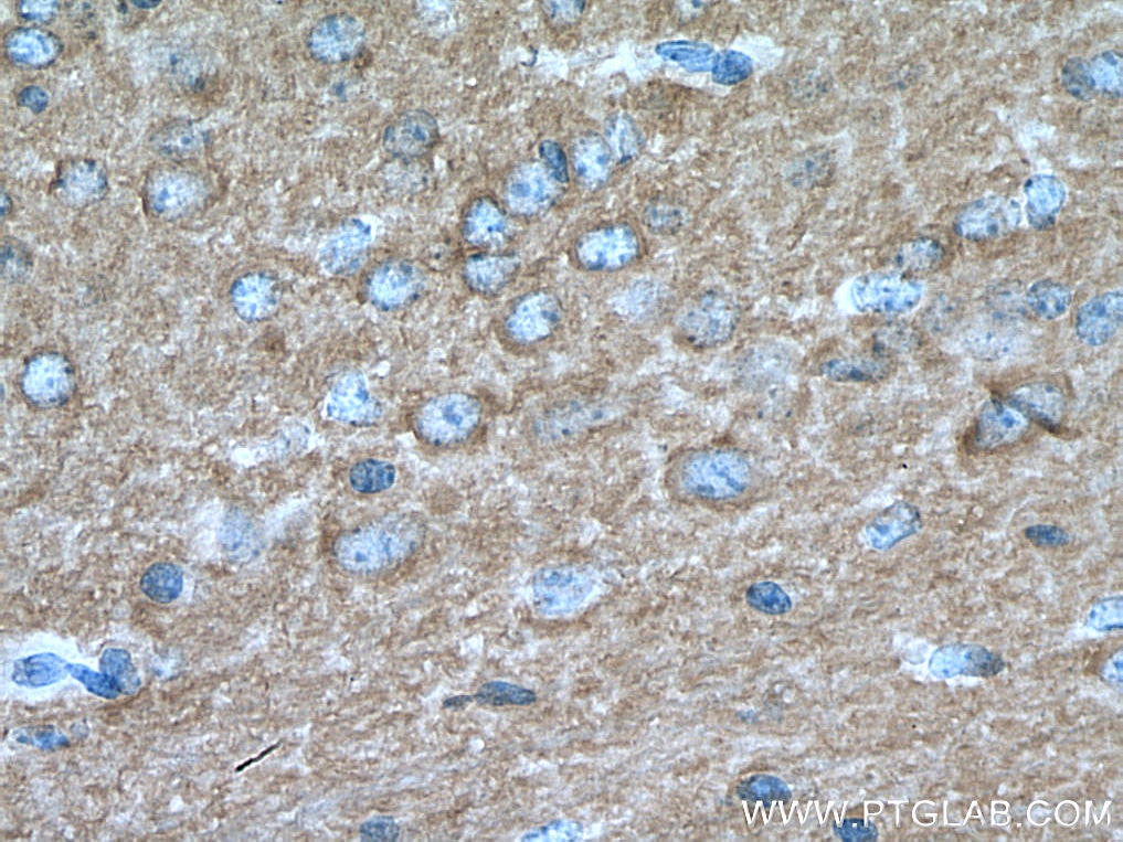 Immunohistochemistry (IHC) staining of mouse brain tissue using IRSp53 Polyclonal antibody (11087-2-AP)