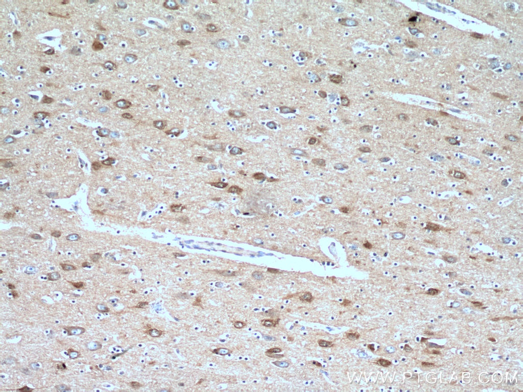 IHC staining of human brain using 11087-2-AP