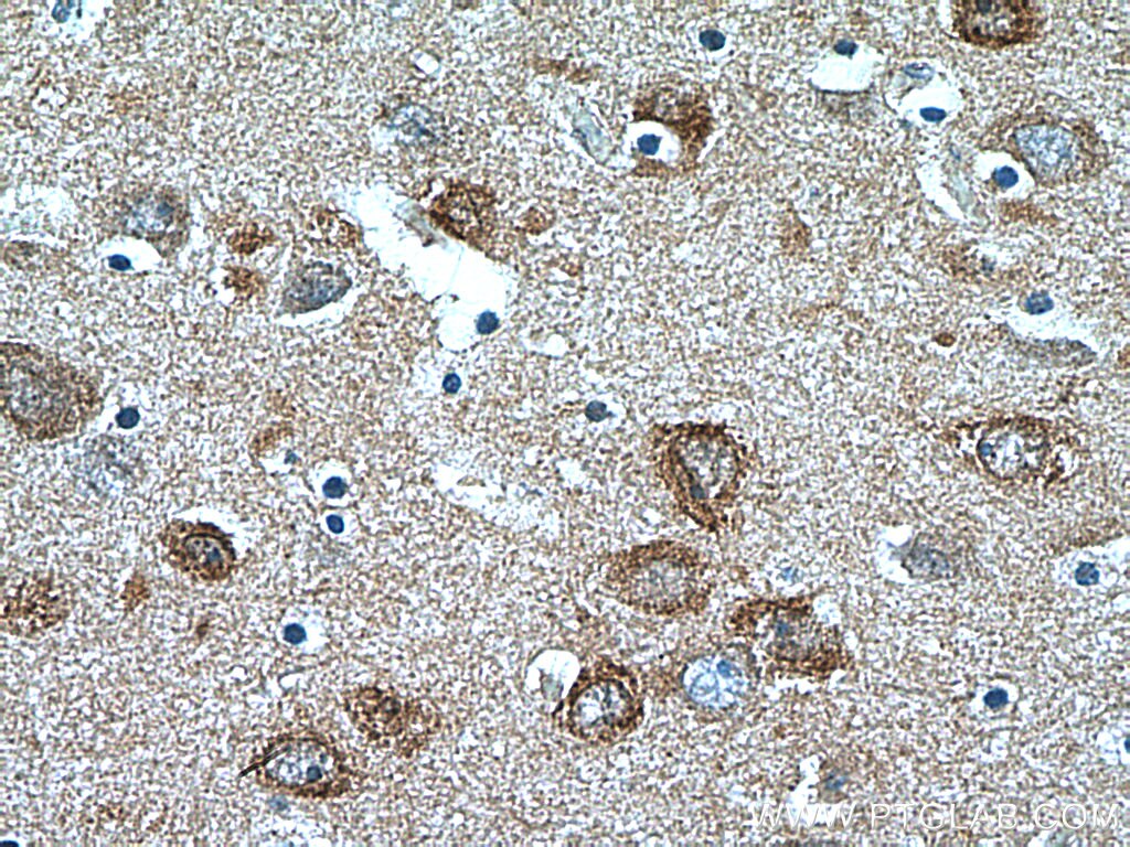 Immunohistochemistry (IHC) staining of human brain tissue using IRSp53 Polyclonal antibody (11087-2-AP)