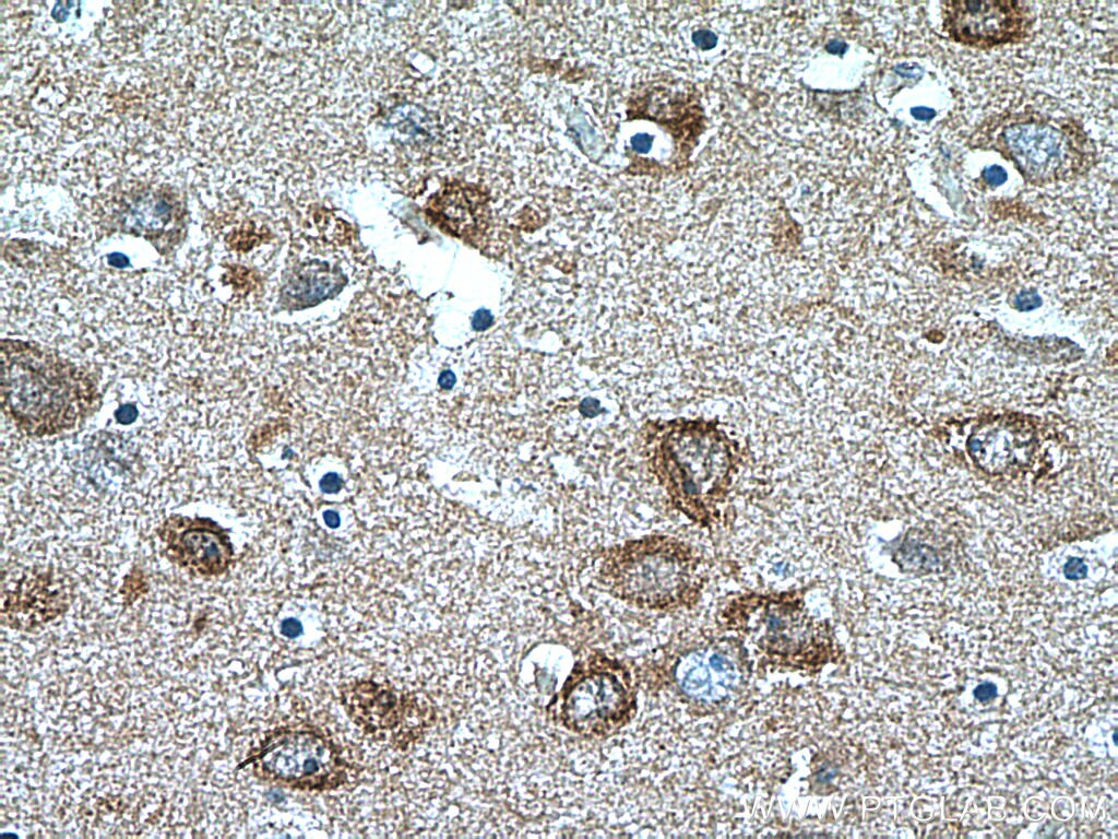 IHC staining of human brain using 11087-2-AP