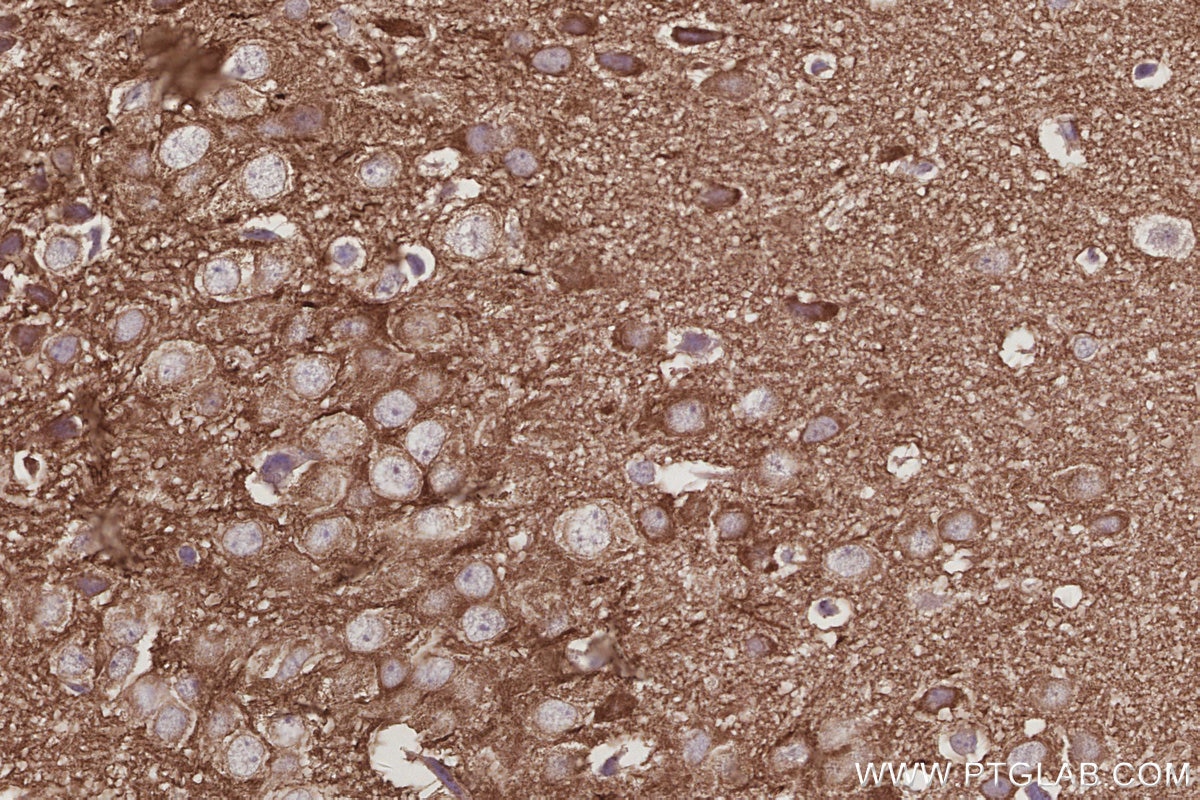 IHC staining of mouse brain using 11087-2-AP Immunohistochemistry (IHC) staining of mouse brain tissue using IRSp53 Polyclonal antibody (11087-2-AP)