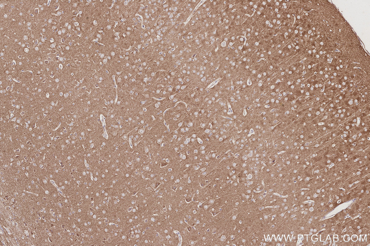 IHC staining of rat brain using 11087-2-AP Immunohistochemistry (IHC) staining of rat brain tissue using IRSp53 Polyclonal antibody (11087-2-AP)