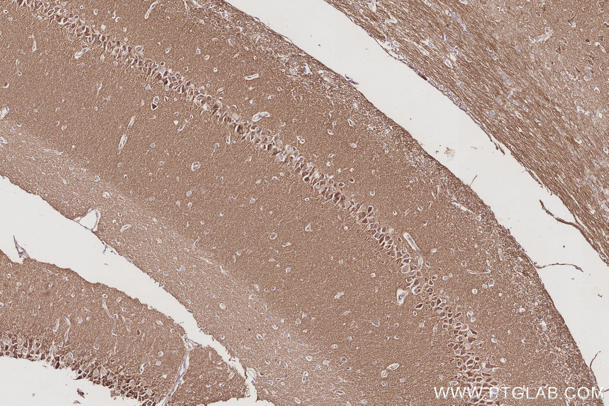 IHC staining of rat brain using 11087-2-AP Immunohistochemistry (IHC) staining of rat brain tissue using IRSp53 Polyclonal antibody (11087-2-AP)