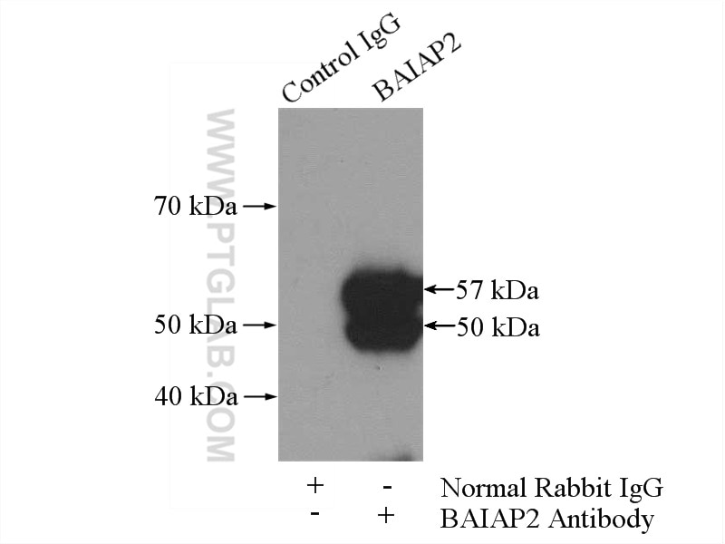 Immunoprecipitation (IP) experiment of mouse brain tissue using IRSp53 Polyclonal antibody (11087-2-AP)