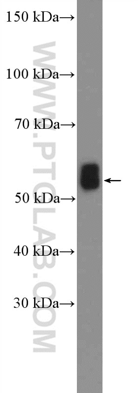 Western Blot (WB) analysis of mouse brain tissue using IRSp53 Polyclonal antibody (11087-2-AP)