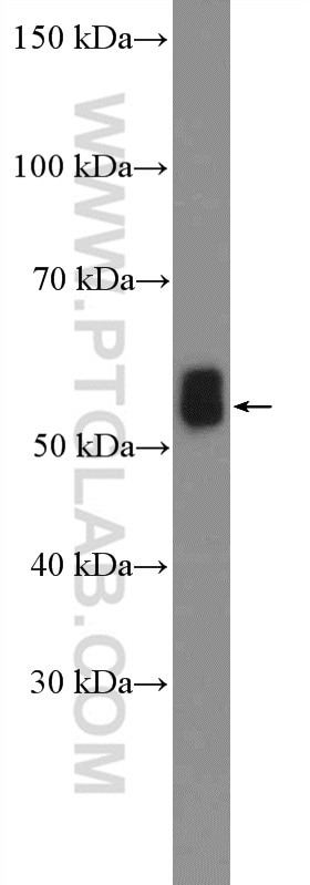 Western Blot (WB) analysis of mouse brain tissue using IRSp53 Polyclonal antibody (11087-2-AP)