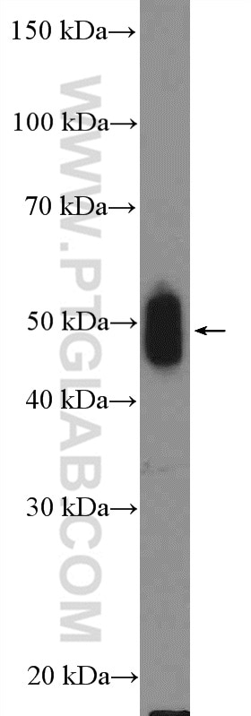 Western Blot (WB) analysis of rat brain tissue using IRSp53 Polyclonal antibody (11087-2-AP)