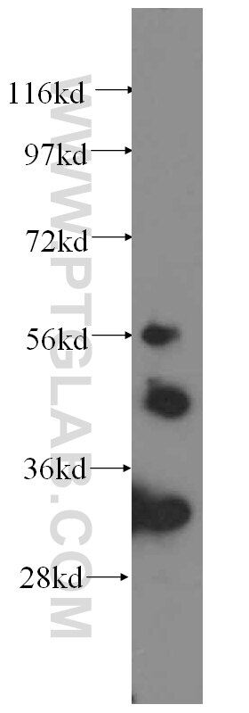 Western Blot (WB) analysis of human brain tissue using IRSp53 Polyclonal antibody (11087-2-AP)