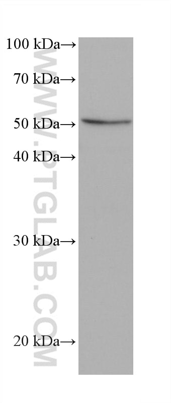 Western Blot (WB) analysis of LNCaP cells using IRSp53 Monoclonal antibody (68348-1-Ig)