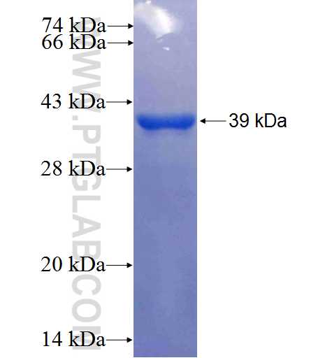 BAIAP2 fusion protein Ag25161 SDS-PAGE