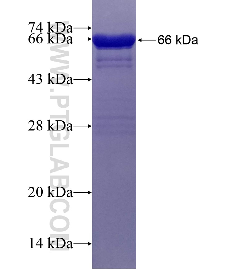 BAIAP2 fusion protein Ag1552 SDS-PAGE