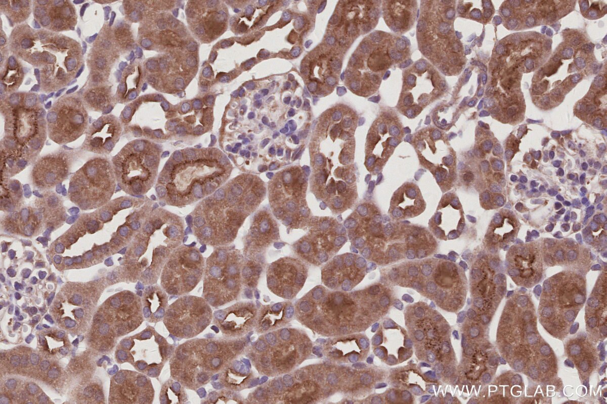 Immunohistochemistry (IHC) staining of mouse kidney tissue using BAIAP2L1 Polyclonal antibody (25692-1-AP)