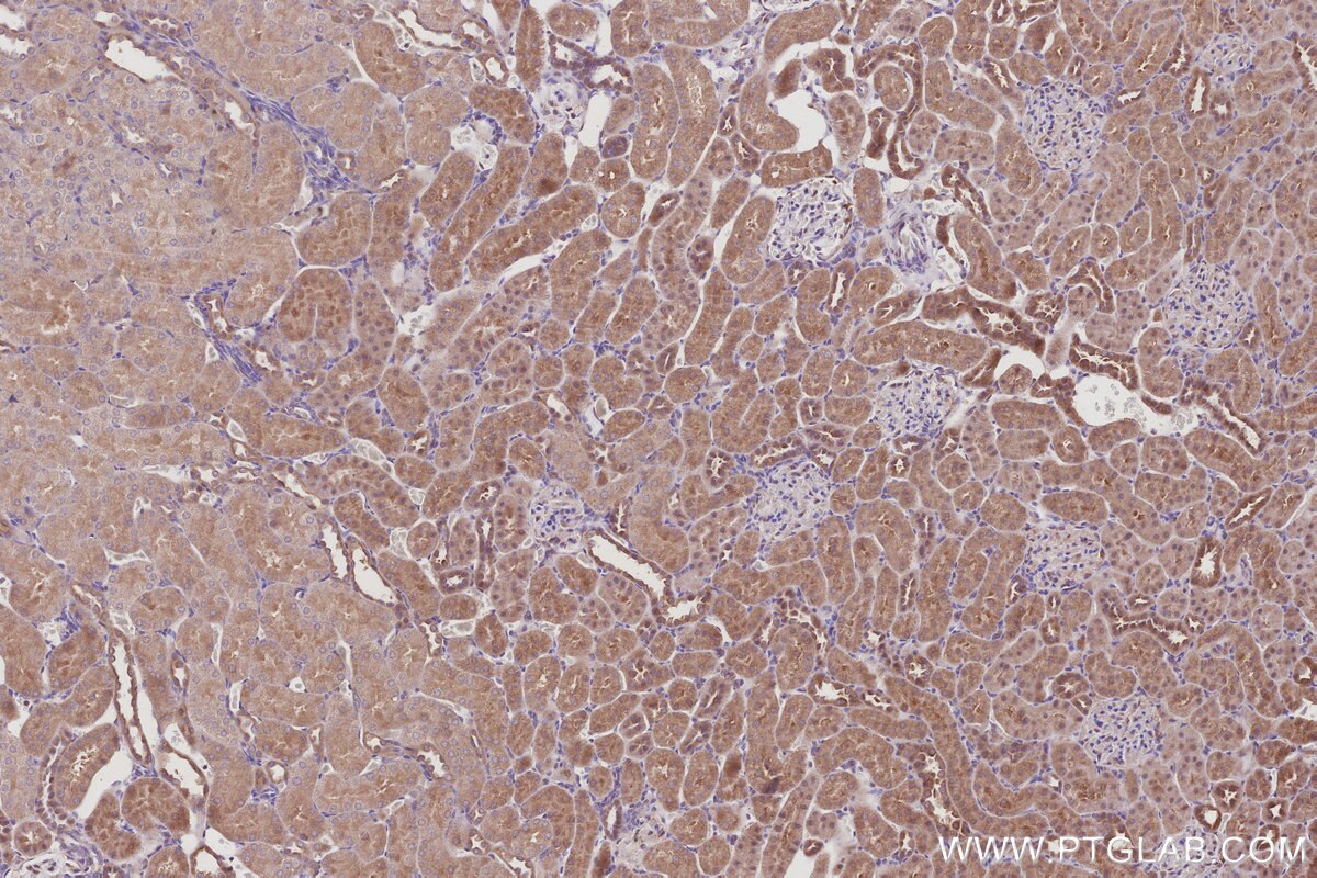 Immunohistochemistry (IHC) staining of rat kidney tissue using BAIAP2L1 Polyclonal antibody (25692-1-AP)