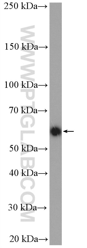 Western Blot (WB) analysis of SGC-7901 cells using BAIAP2L1 Polyclonal antibody (25692-1-AP)