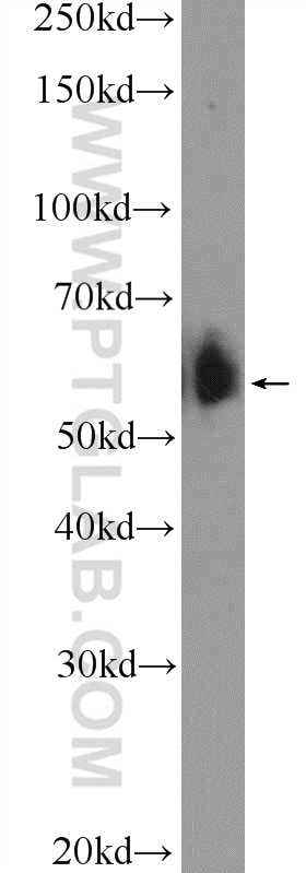 Western Blot (WB) analysis of HeLa cells using BAIAP2L1 Polyclonal antibody (25692-1-AP)