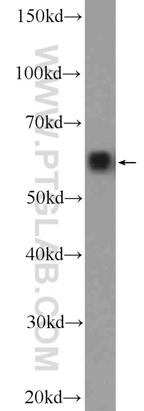 Western Blot (WB) analysis of K-562 cells using BAIAP2L1 Polyclonal antibody (25692-1-AP)