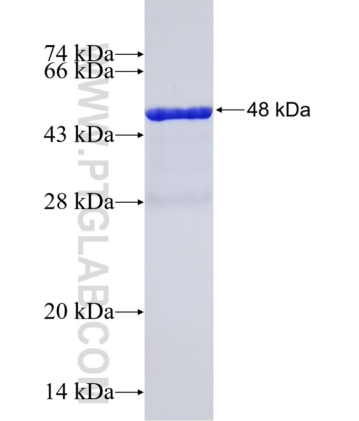 BAIAP2L1 fusion protein Ag22499 SDS-PAGE
