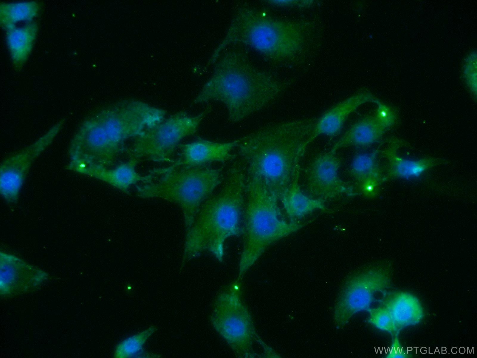 Immunofluorescence (IF) / fluorescent staining of SH-SY5Y cells using BAIAP3 Polyclonal antibody (24836-1-AP)