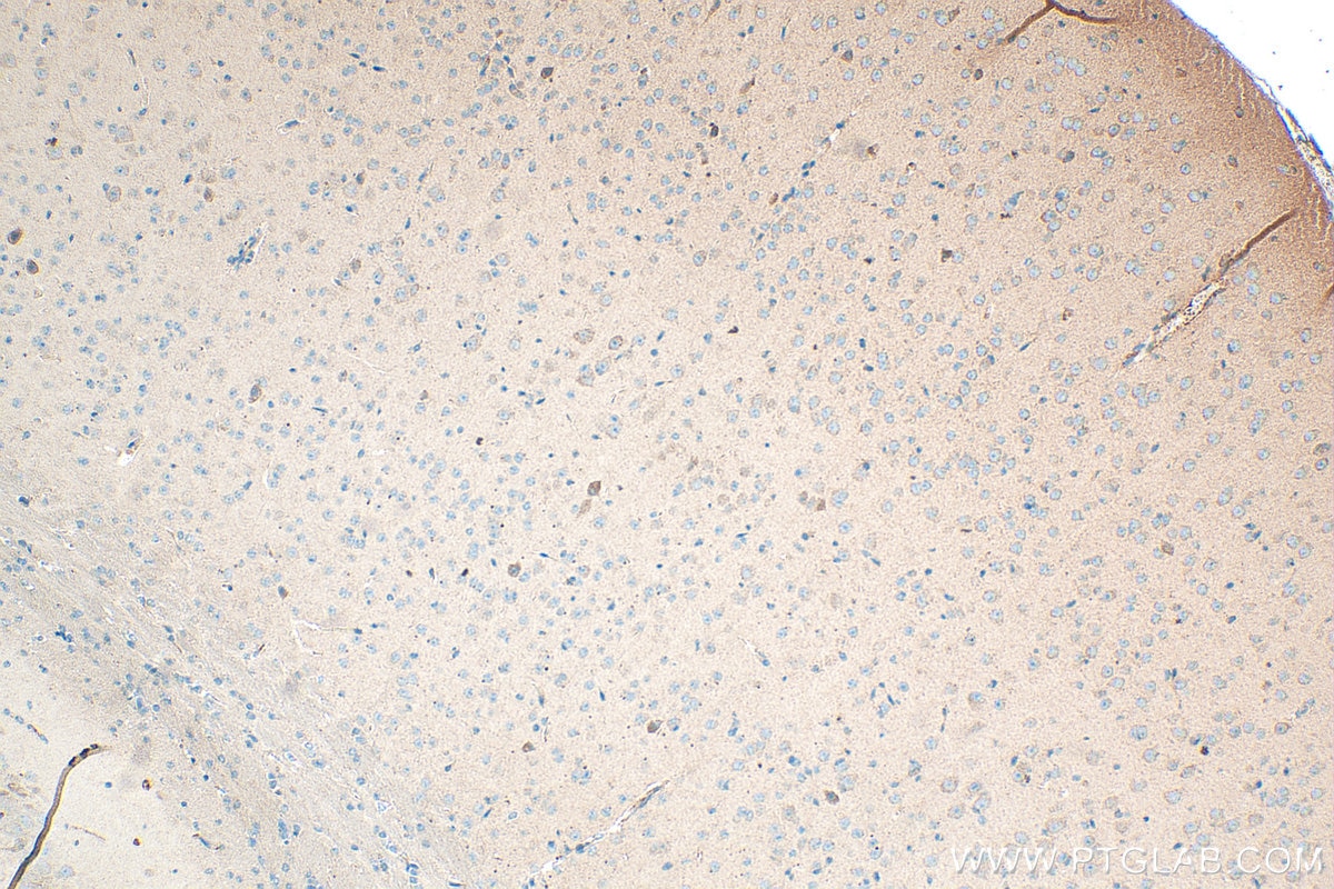Immunohistochemistry (IHC) staining of mouse brain tissue using BAIAP3 Polyclonal antibody (24836-1-AP)