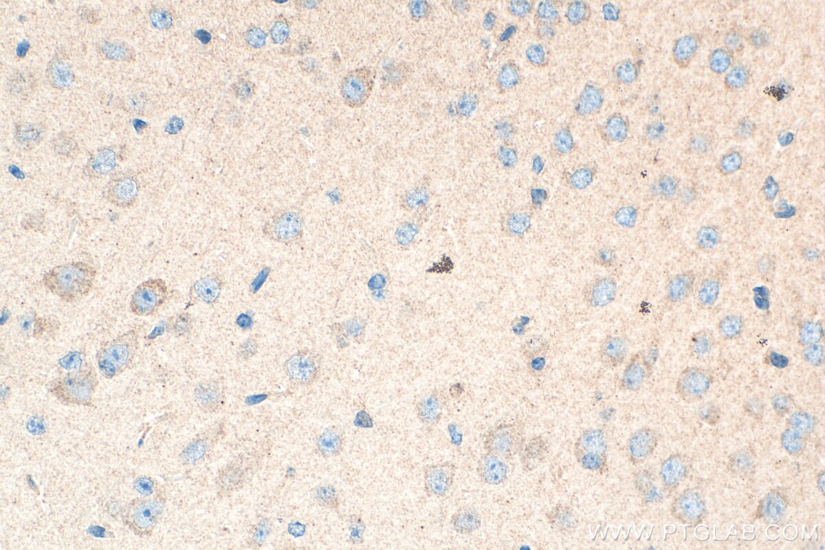 Immunohistochemistry (IHC) staining of mouse brain tissue using BAIAP3 Polyclonal antibody (24836-1-AP)
