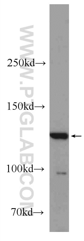 Western Blot (WB) analysis of mouse brain tissue using BAIAP3 Polyclonal antibody (24836-1-AP)