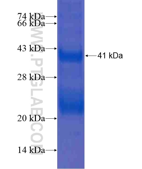 BAIAP3 fusion protein Ag21219 SDS-PAGE