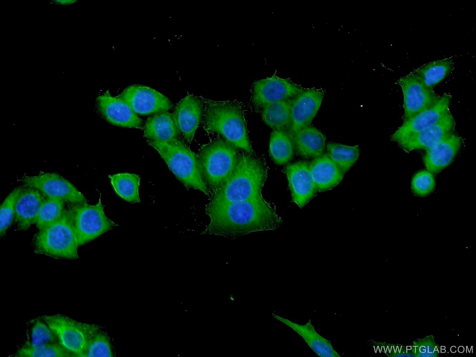 BAK Polyclonal antibody