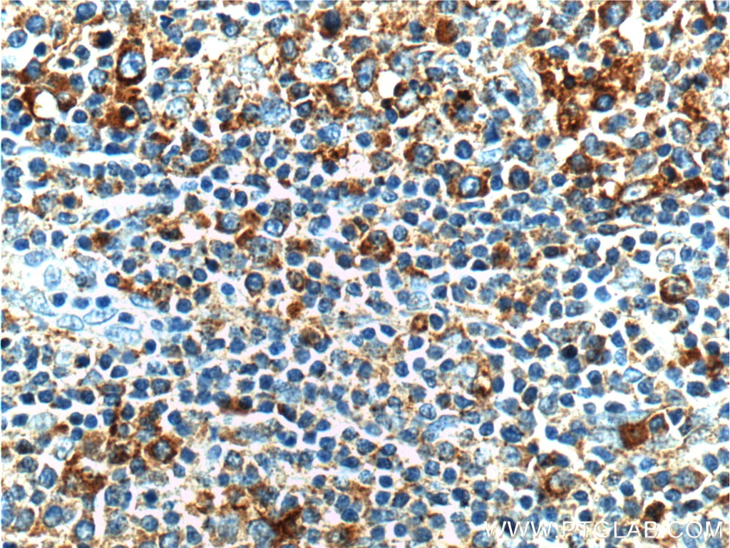 BAK Polyclonal antibody