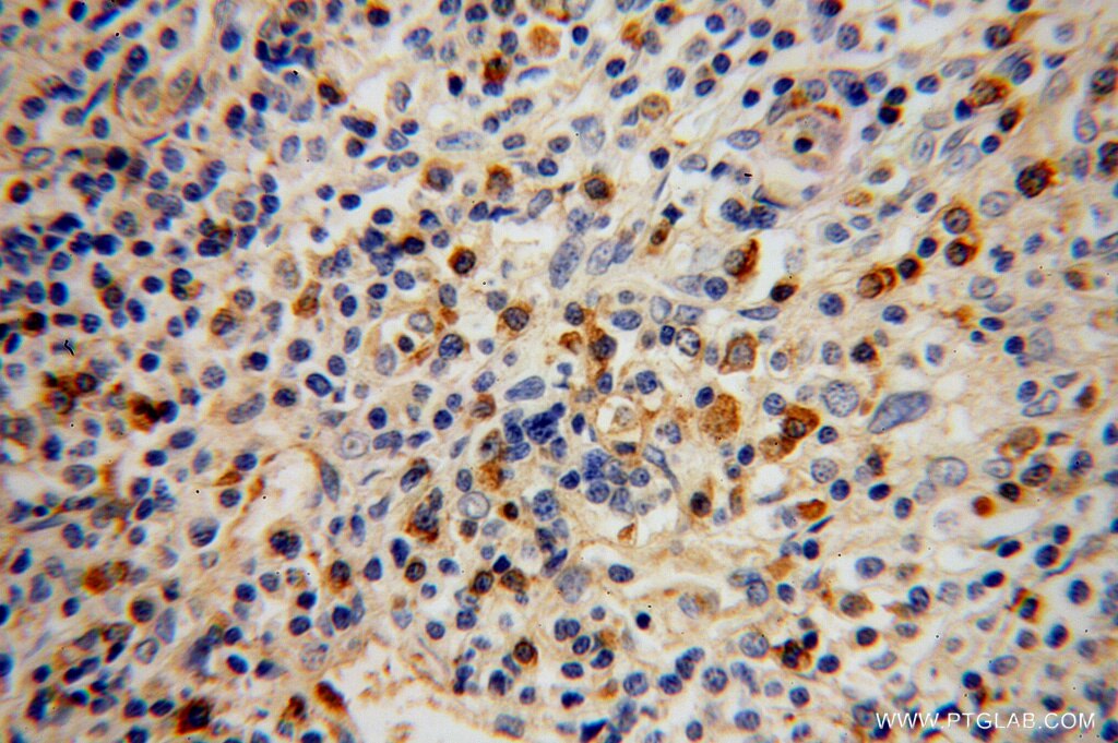 BAK Polyclonal antibody