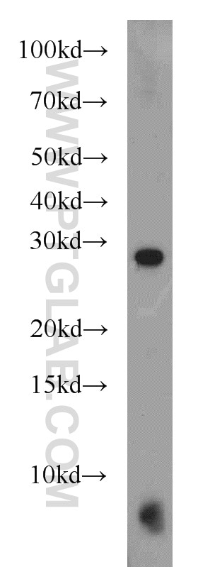 BAK Polyclonal antibody