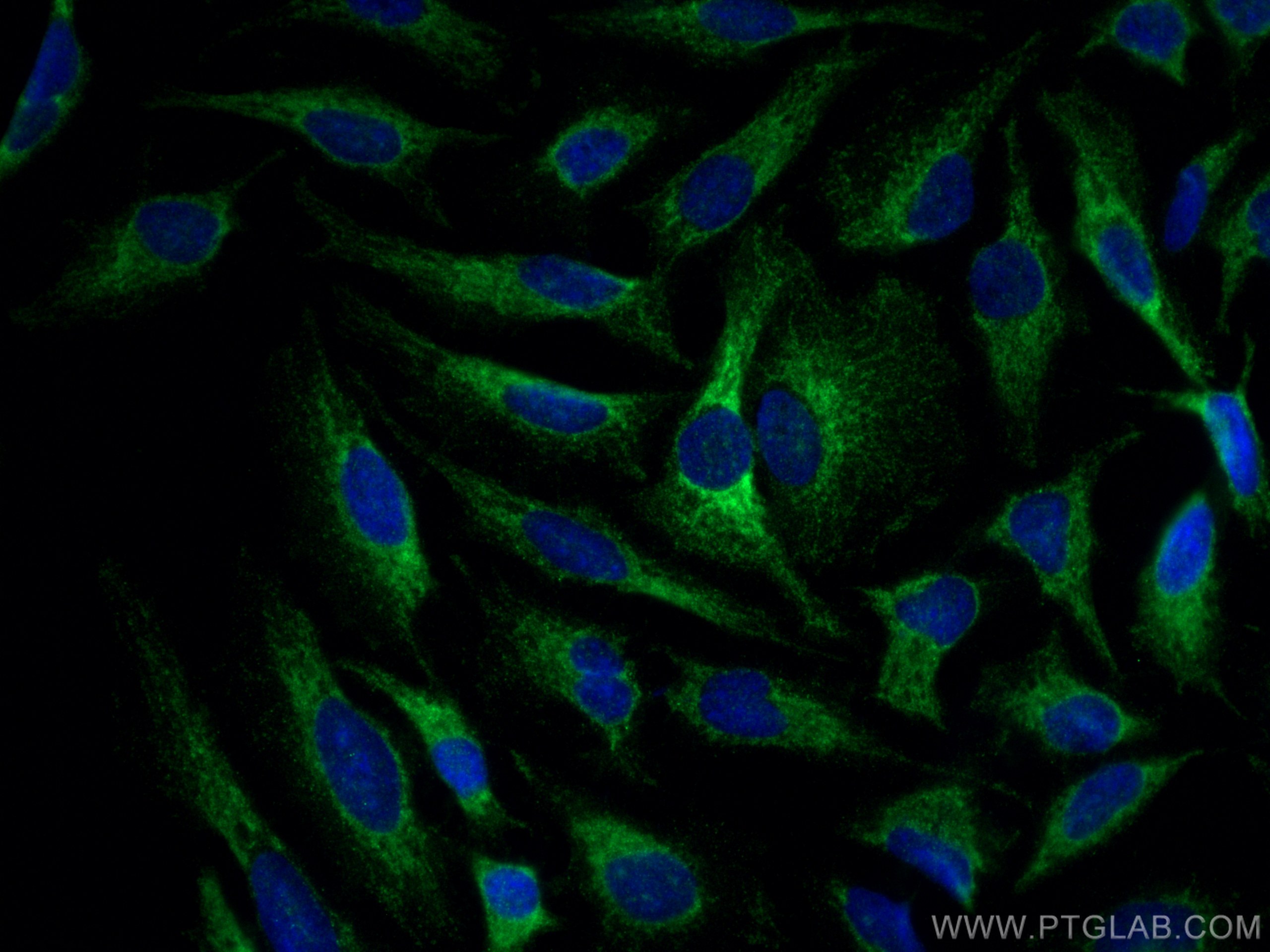 Immunofluorescence (IF) / fluorescent staining of HeLa cells using BAK Polyclonal antibody (29552-1-AP)