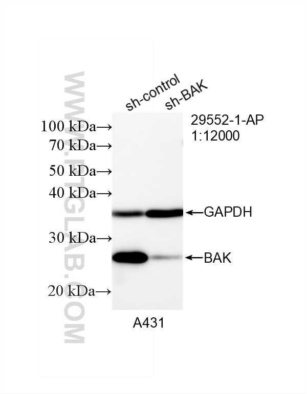 Western Blot (WB) analysis of A431 cells using BAK Polyclonal antibody (29552-1-AP)