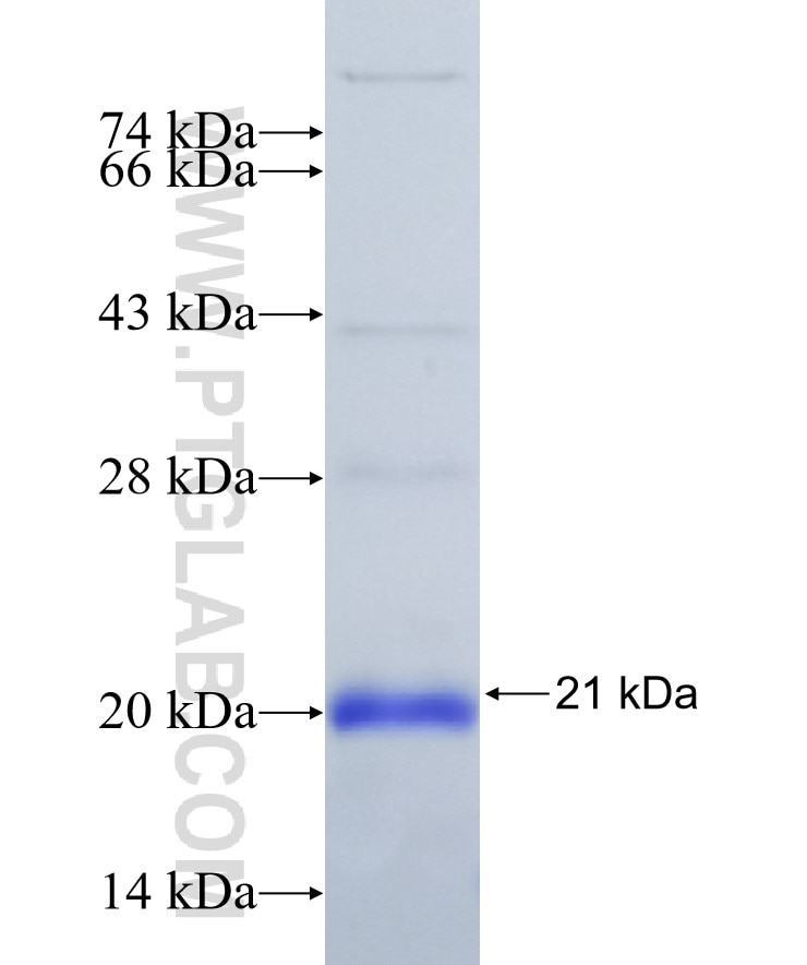 BAK fusion protein Ag31034 SDS-PAGE