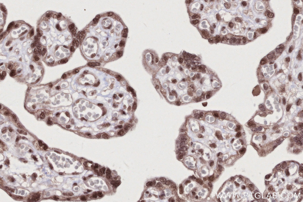 Immunohistochemistry (IHC) staining of human placenta tissue using BANP Polyclonal antibody (16393-1-AP)