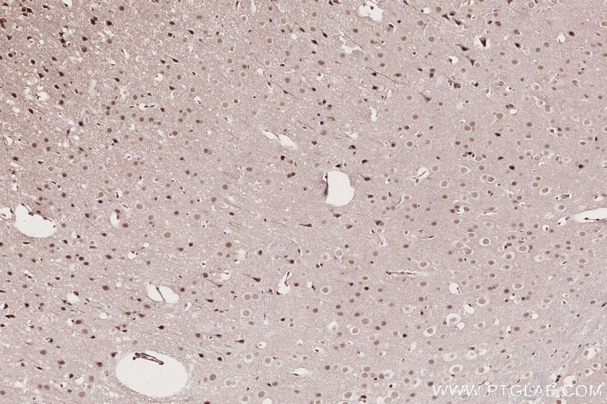 Immunohistochemistry (IHC) staining of mouse brain tissue using BANP Polyclonal antibody (16393-1-AP)