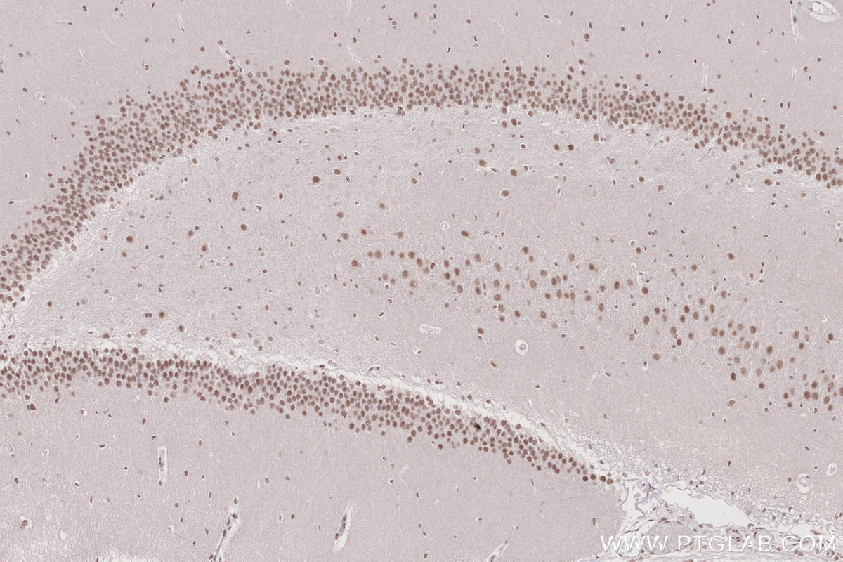 Immunohistochemistry (IHC) staining of rat brain tissue using BANP Polyclonal antibody (16393-1-AP)