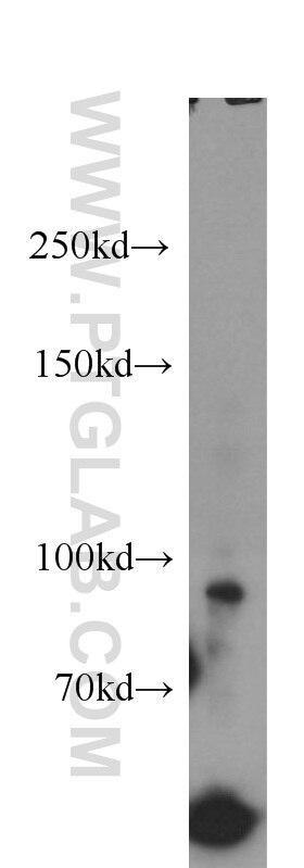 WB analysis of human placenta using 10398-1-AP