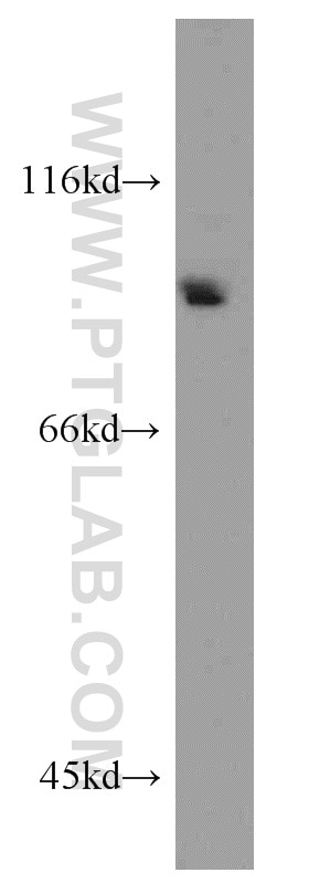 Western Blot (WB) analysis of A2780 cells using BAP1 Polyclonal antibody (10398-1-AP)