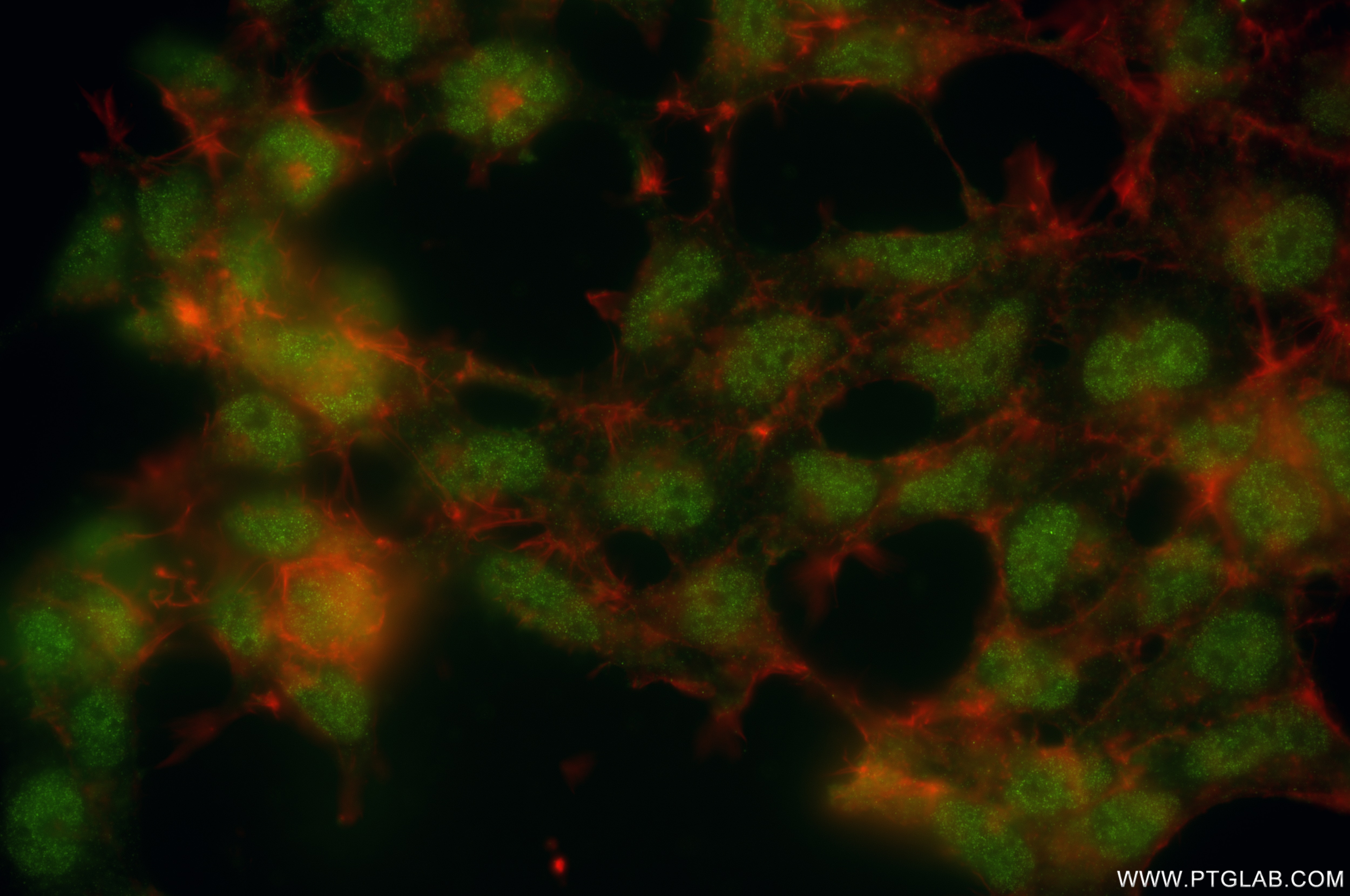 Immunofluorescence (IF) / fluorescent staining of HEK-293 cells using BAP1 Recombinant antibody (83371-1-RR)