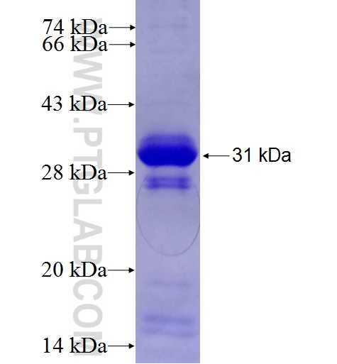 BAP1 fusion protein Ag27333 SDS-PAGE