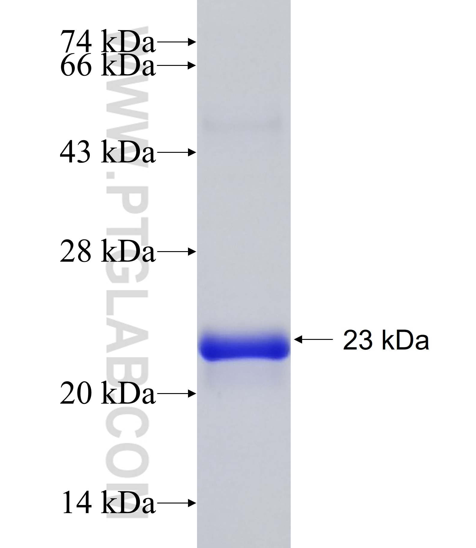BAP1 fusion protein Ag34472 SDS-PAGE BAP1 fusion protein Ag34472 SDS-PAGE