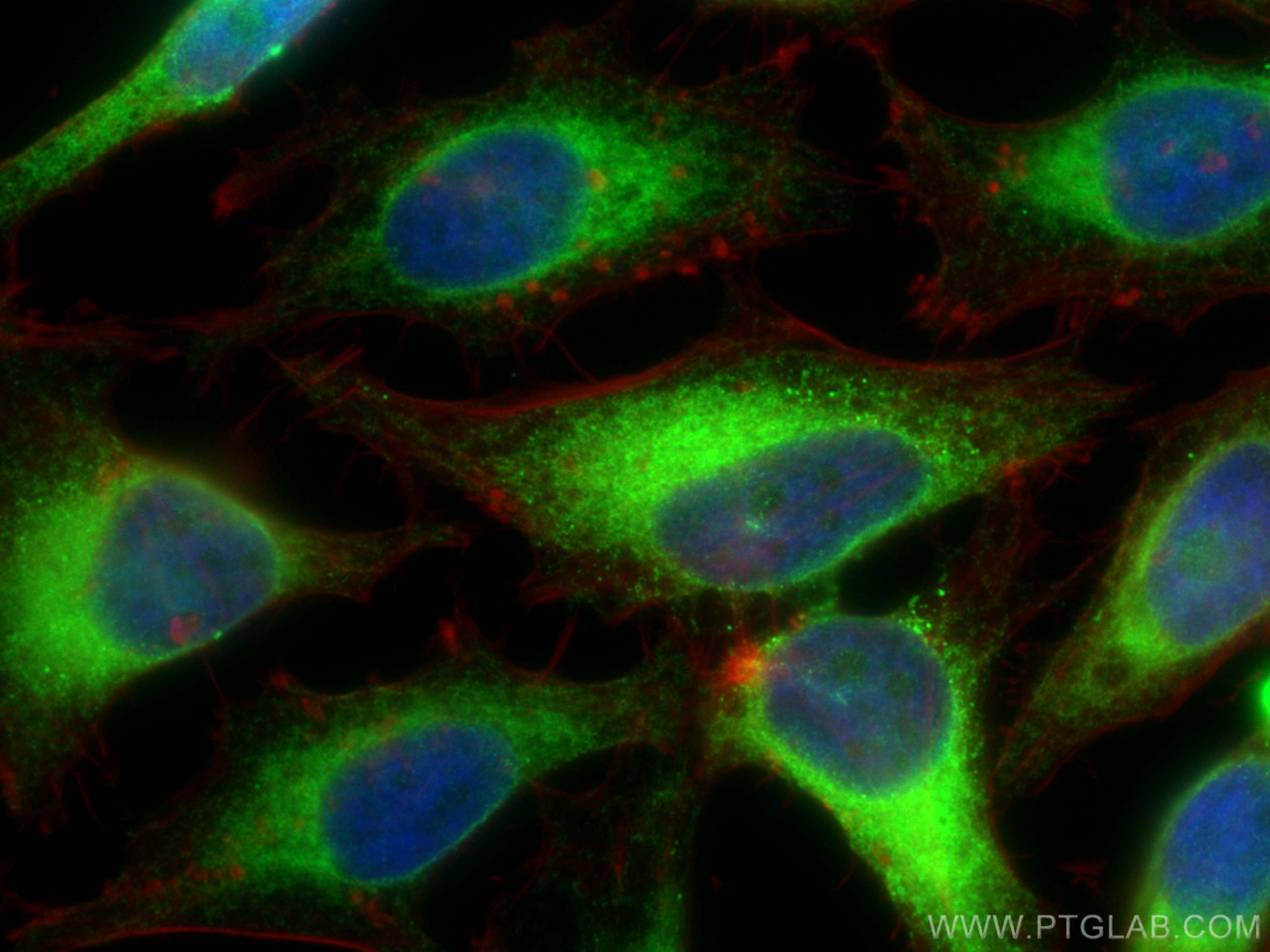 Immunofluorescence (IF) / fluorescent staining of HeLa cells using CoraLite® Plus 488-conjugated BAP31 Polyclonal ant (CL488-11200)