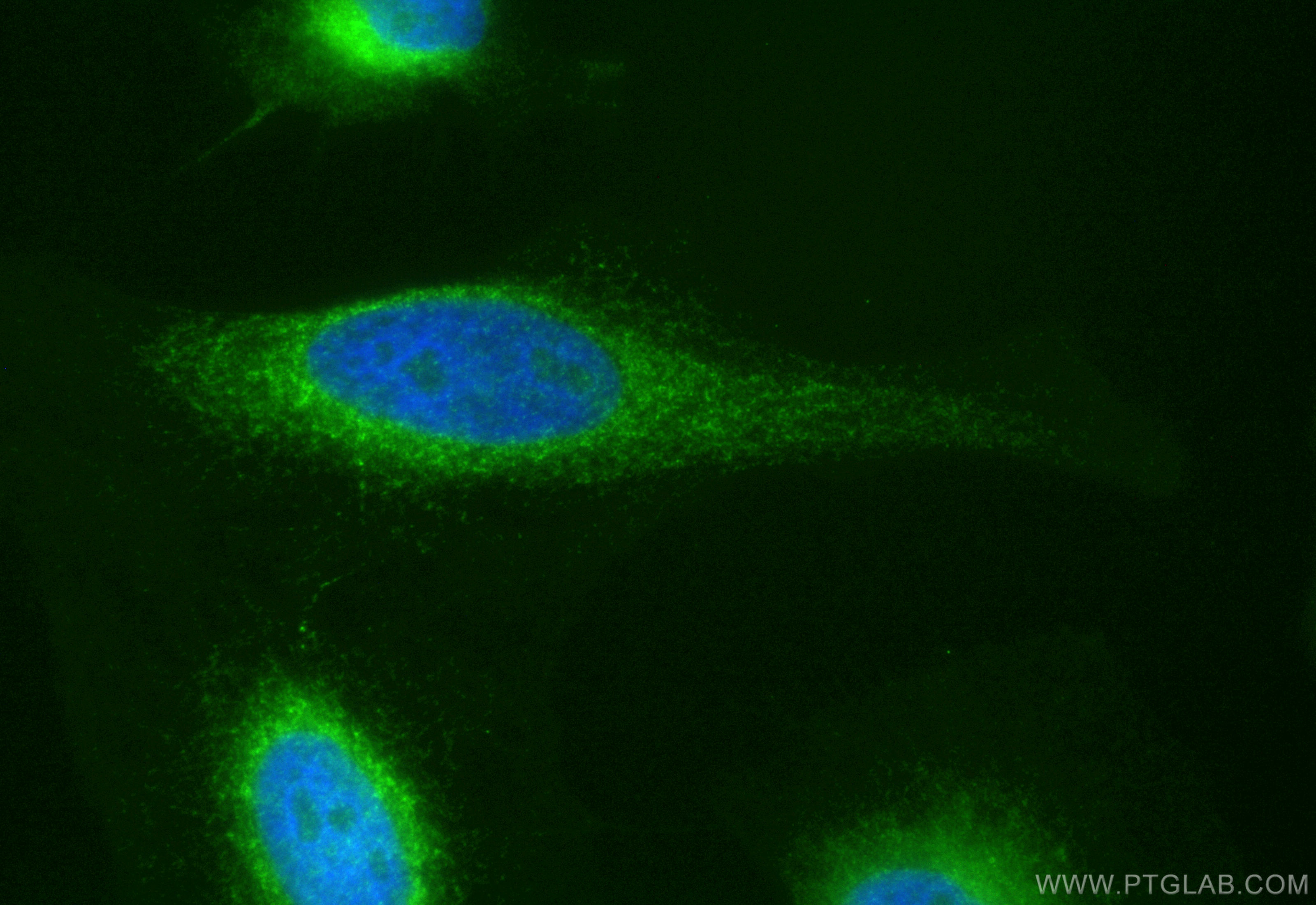Immunofluorescence (IF) / fluorescent staining of HeLa cells using CoraLite® Plus 488-conjugated BAP31 Recombinant an (CL488-84584-5)