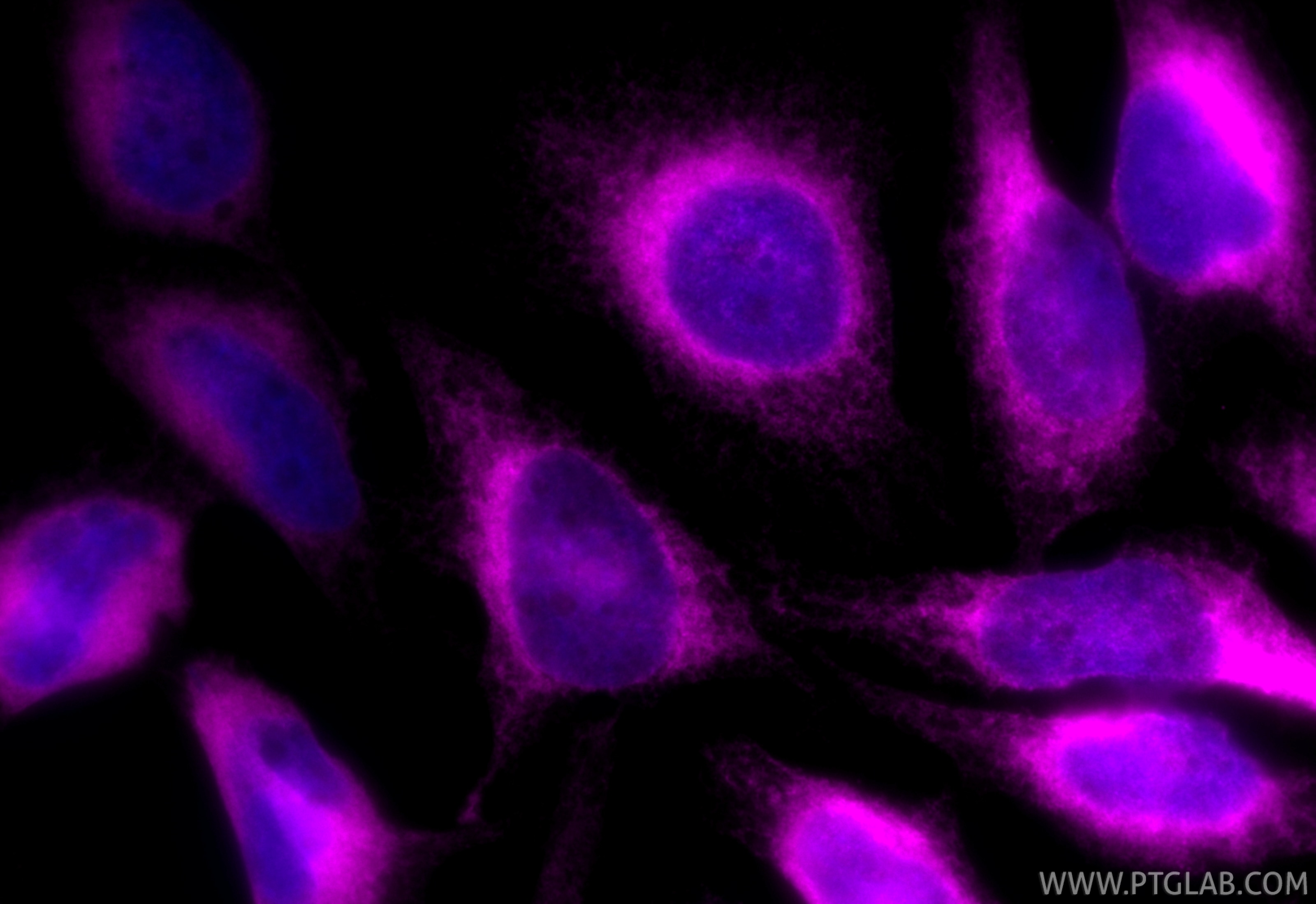 IF Staining of HeLa using CL647-11200 Immunofluorescence (IF) / fluorescent staining of HeLa cells using CoraLite® Plus 647-conjugated BAP31 Polyclonal ant (CL647-11200)