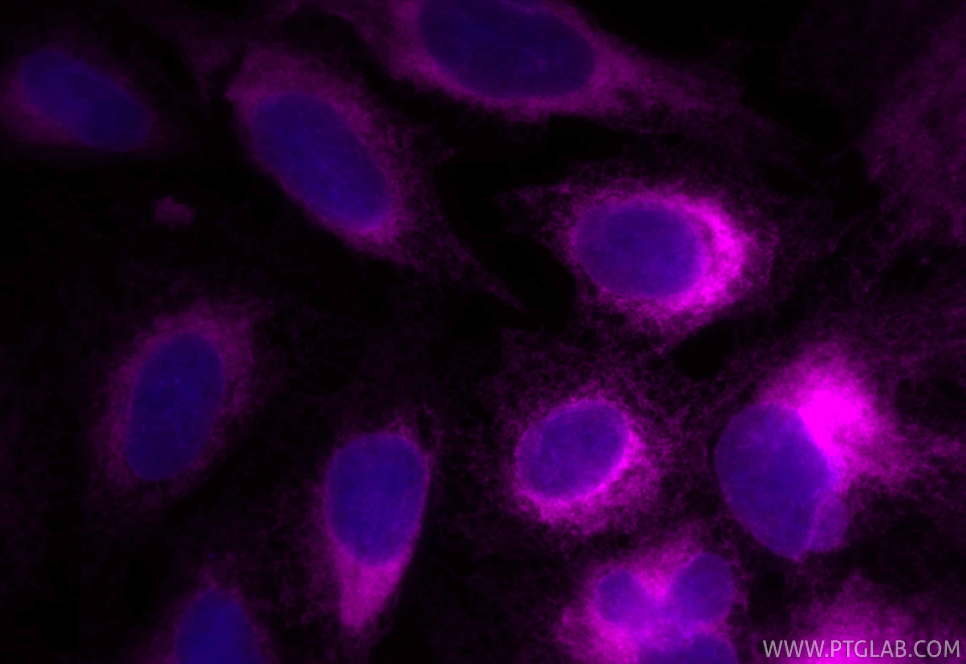 IF Staining of U2OS using CL647-11200 Immunofluorescence (IF) / fluorescent staining of U2OS cells using CoraLite® Plus 647-conjugated BAP31 Polyclonal ant (CL647-11200)