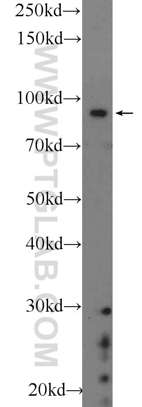 Western Blot (WB) analysis of SH-SY5Y cells using BARD1 Polyclonal antibody (22964-1-AP)