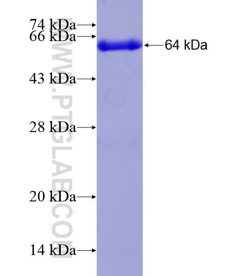 BARD1 fusion protein Ag18782 SDS-PAGE