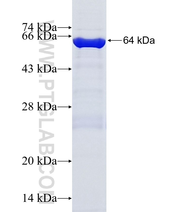 BARD1 fusion protein Ag18782 SDS-PAGE