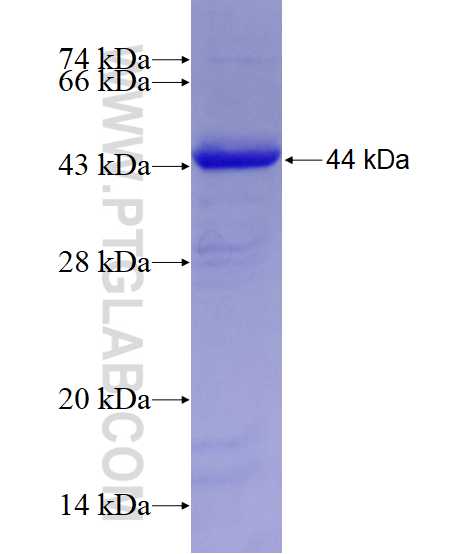 BARD1 fusion protein Ag18965 SDS-PAGE